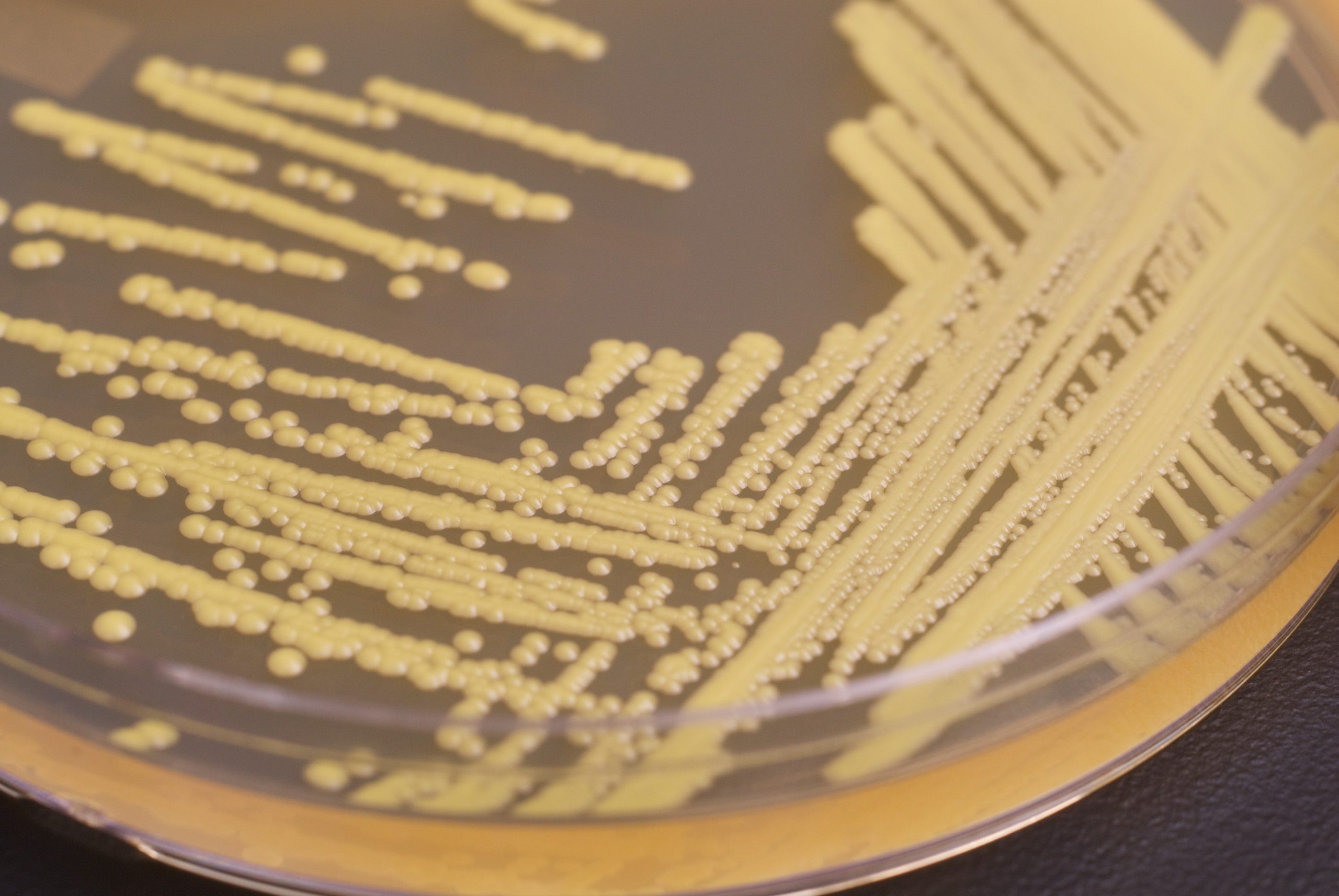 Nelson Labs employee monitoring environmental plate