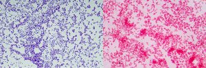 Gram-positive bacteria (left) and Gram-negative bacteria (right).